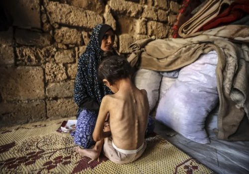 A mother comforts her malnourished 6-year-old daughter at a shelter in central Gaza City, May 11, 2025.
© 2025 Majdi Fathi/NurPhoto via AP Photo / Source: Human Rights Watch