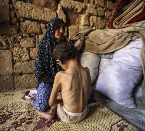 A mother comforts her malnourished 6-year-old daughter at a shelter in central Gaza City, May 11, 2025.
© 2025 Majdi Fathi/NurPhoto via AP Photo / Source: Human Rights Watch