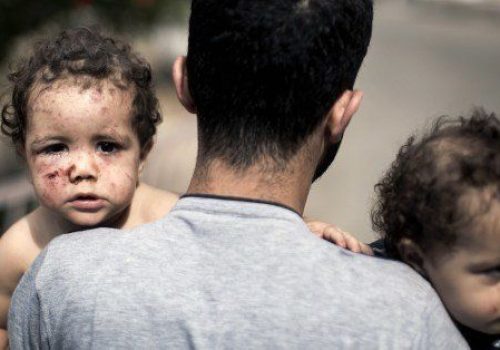 A Palestinian man holds his daughters, Shada and Lama al-Ejla, who were injured in an Israeli tank attack, as he leaves al-Shifa hospital on July 18, 2014 in Gaza City. Israel warned it could broaden a Gaza ground assault aimed at smashing Hamas's network of cross-border tunnels, as it stepped up attacks that have killed more than 260 Palestinians. AFP PHOTO / MAHMUD HAMS (Photo credit should read MAHMUD HAMS/AFP/Getty Images)